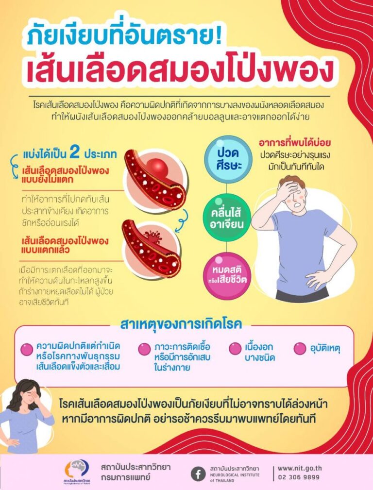 กรมการแพทย์เตือน เส้นเลือดสมองโป่งพอง…ภัยเงียบที่อันตราย!
